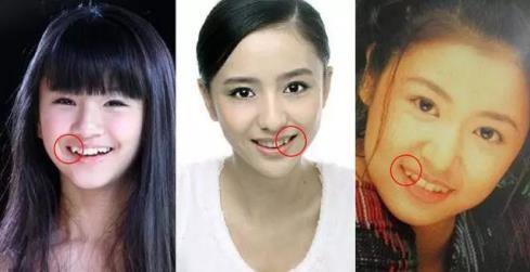 上牙代表父母下牙代表儿女真的吗 (哪个牙齿代表父母)插图3