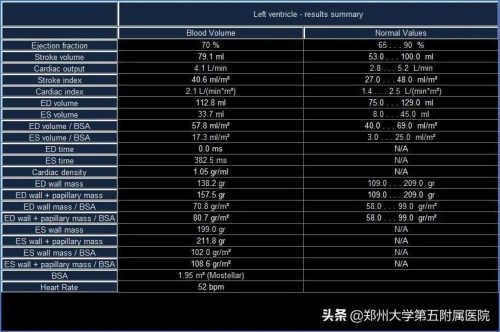 cmr垂直盘什么意思 (浅谈心脏磁共振)插图