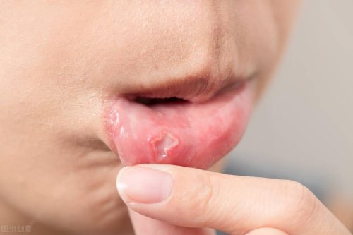 蒙脱石散正确服用方法(蒙脱石散正确服用方法饭前饭后)插图8