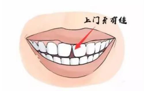 上牙代表父母下牙代表儿女 (从牙齿看相)插图1
