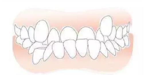 上牙代表父母下牙代表儿女 (从牙齿看相)插图5