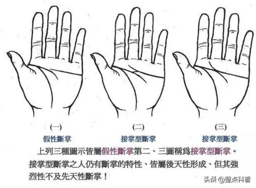 断掌纹的男人婚姻怎么样(双手断掌的男人感情和婚姻)插图4