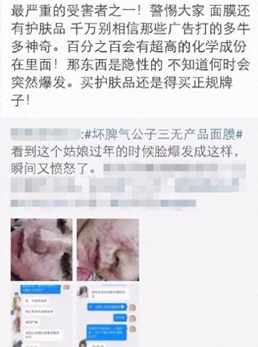 十大野生护肤品排行榜(口碑最好十大护肤品)插图11