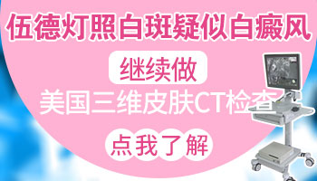 伍德灯检查颜色对照表(伍德氏灯颜色对照表)插图3