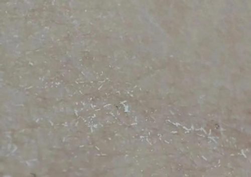 蚊虫止痒膏十大排行榜(止痒药膏第一名)插图5
