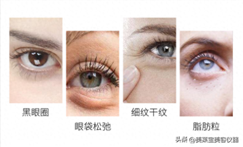 美眼仪十大排行榜(热眼仪推荐)插图