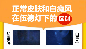 伍德灯检查颜色对照表(伍德氏灯颜色对照表)插图2