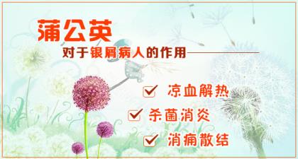偏方治牛皮癣最快的方法(有哪些偏方能治牛皮癣)插图1