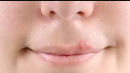 十大口腔疾病排行榜最新(口腔常见的十大疾病)插图