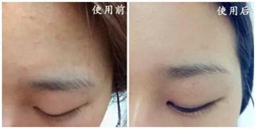 芬兰过敏药膏排名前十(染头过敏抹什么药膏)插图14