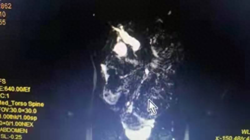广西儿科外科排名前十(南宁儿科专家排名前十名)插图6