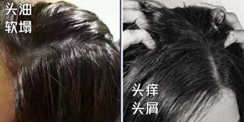 平价冼发水十大排行榜(必买的洗发水排行榜)插图2