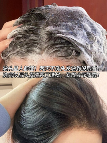平价冼发水十大排行榜(必买的洗发水排行榜)插图9