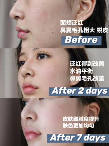 十大全部修复乳霜排行榜(疤痕修复十大品牌)插图10