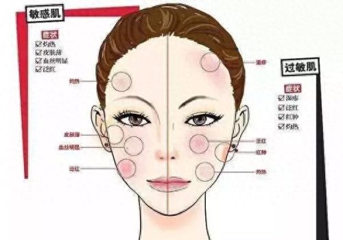 芬兰过敏药膏排名前十(染头过敏抹什么药膏)插图11