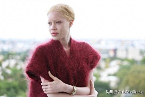 全球十大截肢美女排行榜(截肢美女抖音)插图8