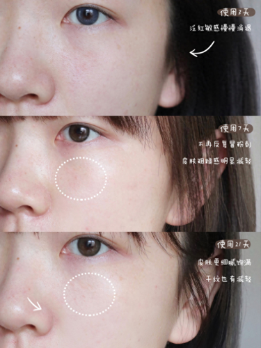 十大全部修复乳霜排行榜(疤痕修复十大品牌)插图4