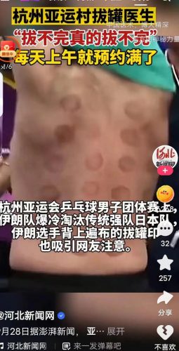 杭州欧式推拿排名前十(推拿)插图
