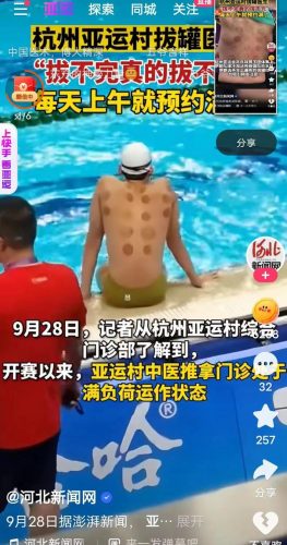 杭州欧式推拿排名前十(推拿)插图1