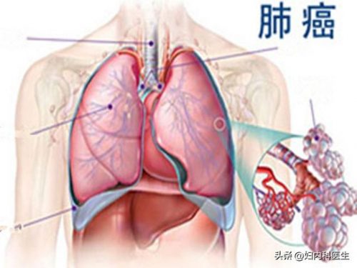 新加坡哮喘医生排名前十(全国十大哮喘医院排名)插图1