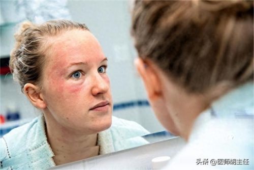 眼部湿疹药膏排名前十(湿疹的药膏排名表)插图8