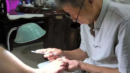 世界修脚大师排名前十(排名第一的修脚是哪家)插图