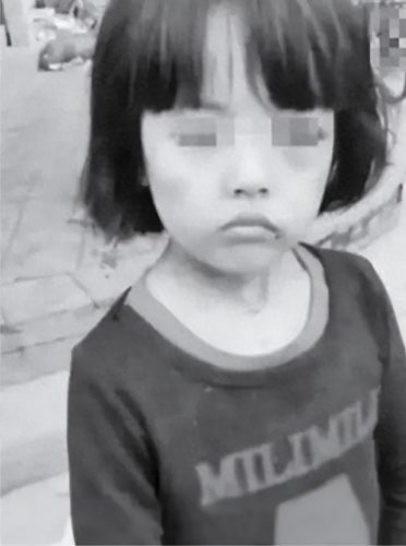 全球最惨小孩排名前十(世上最惨的小女孩)插图6