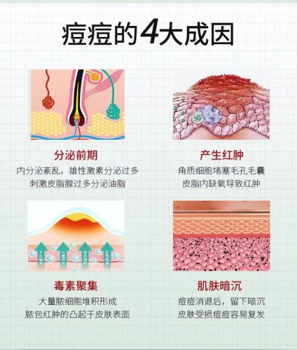 祛痘产品排行榜3强(排名第一的祛痘产品)插图3