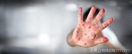贵阳老年医院排名前十(贵阳老年人体检哪里比较好)插图5