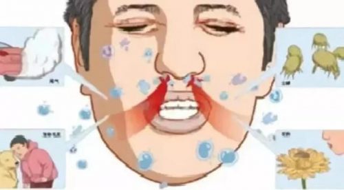外用延时喷剂排行榜哪个最好(男科脱敏针一针多少钱)插图12