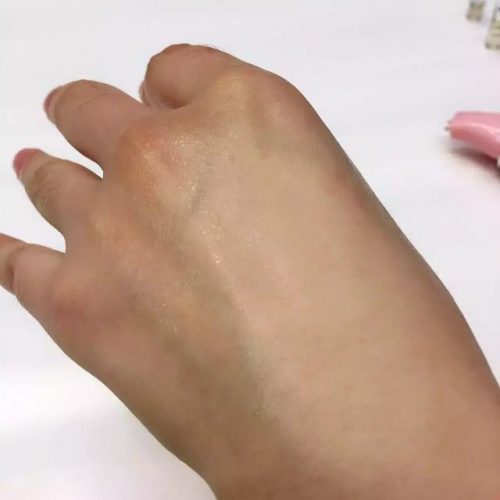 欧洲玻尿酸品牌排行榜(进口玻尿酸有哪些品牌)插图12