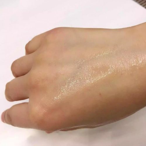 欧洲玻尿酸品牌排行榜(进口玻尿酸有哪些品牌)插图27