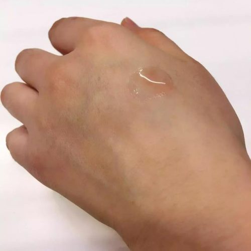 欧洲玻尿酸品牌排行榜(进口玻尿酸有哪些品牌)插图6